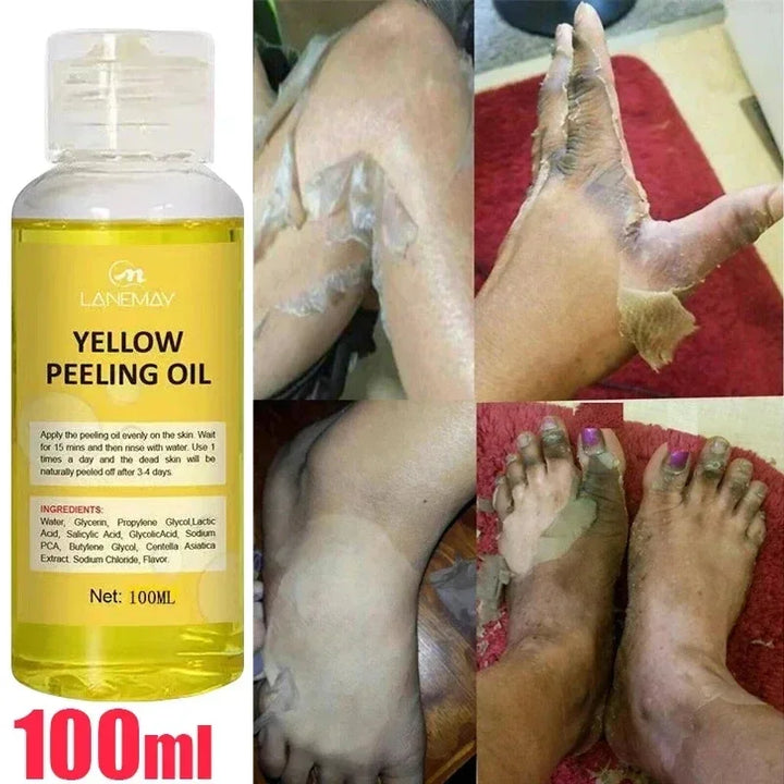 Organic Yellow Peeling Oil Serum