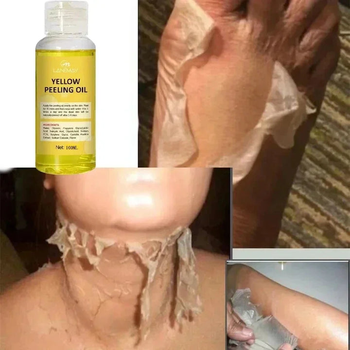 Organic Yellow Peeling Oil Serum