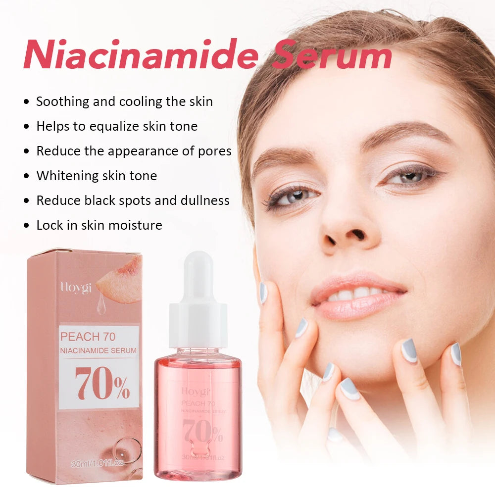 30ml Niacinamide Dark Spot Serum – Brightening & Hydrating