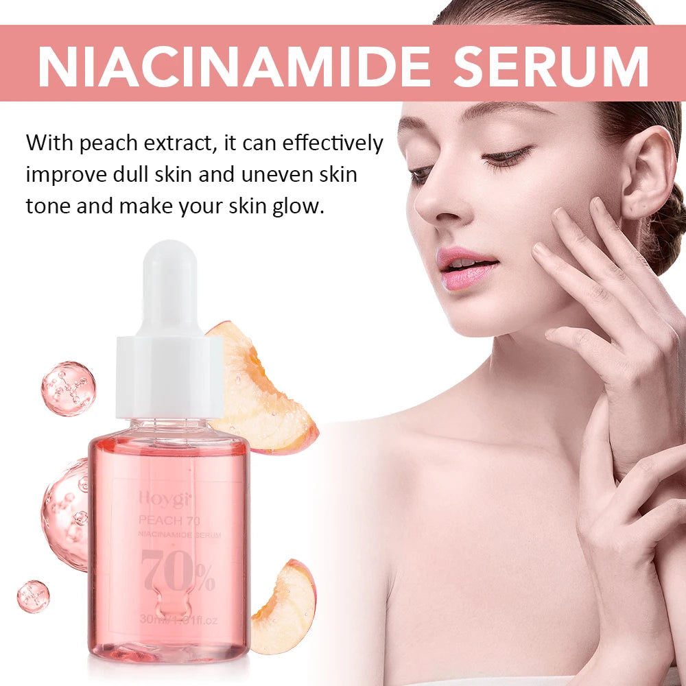 30ml Niacinamide Dark Spot Serum – Brightening & Hydrating