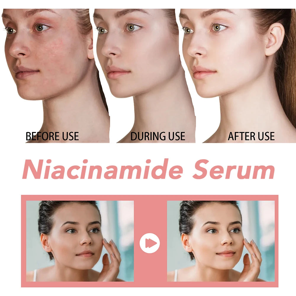 30ml Niacinamide Dark Spot Serum – Brightening & Hydrating