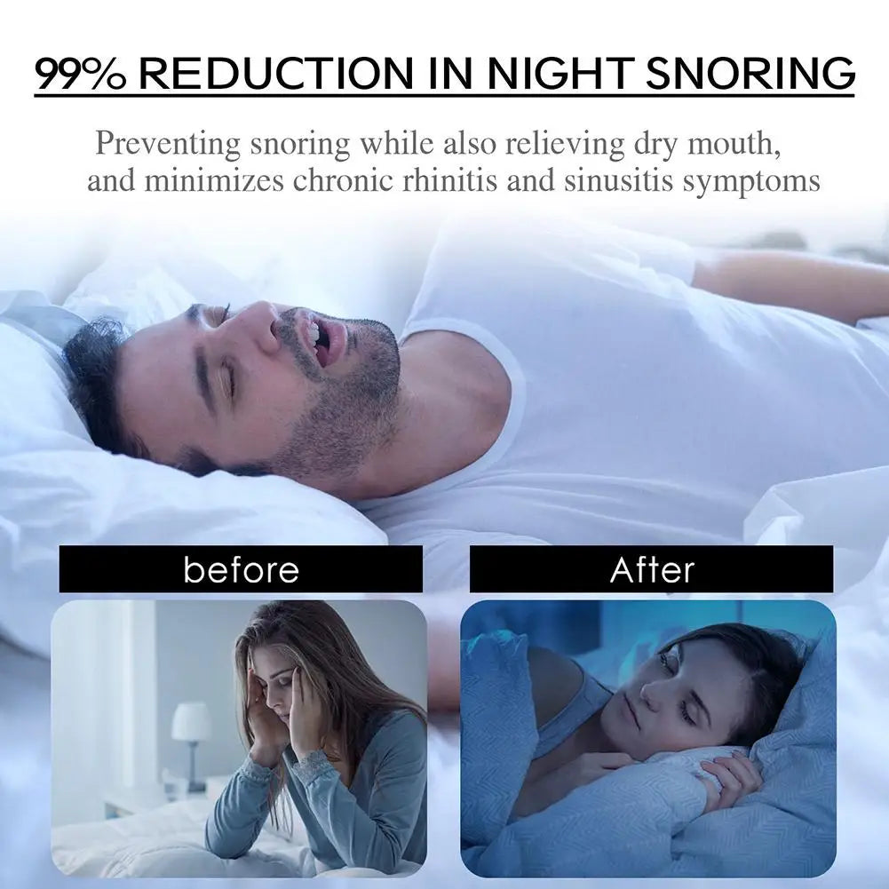 Anti-Snoring Mouth Tape – Nose Breathing Sleep Strips