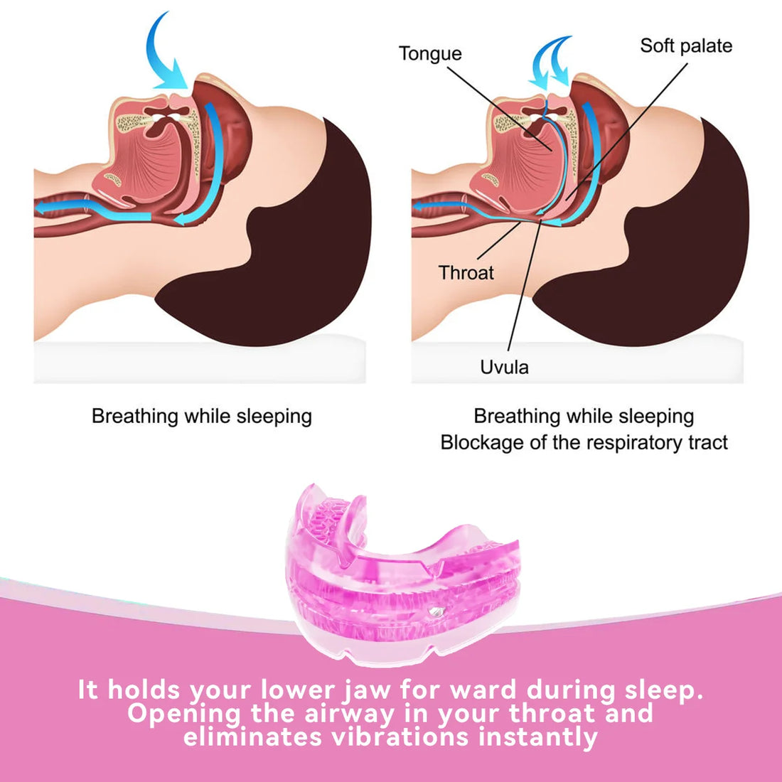 Anti-Snore & Bruxism Mouth Guard