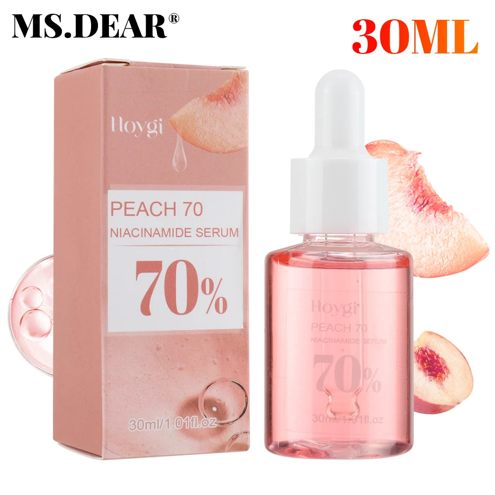 30ml Niacinamide Dark Spot Serum – Brightening & Hydrating