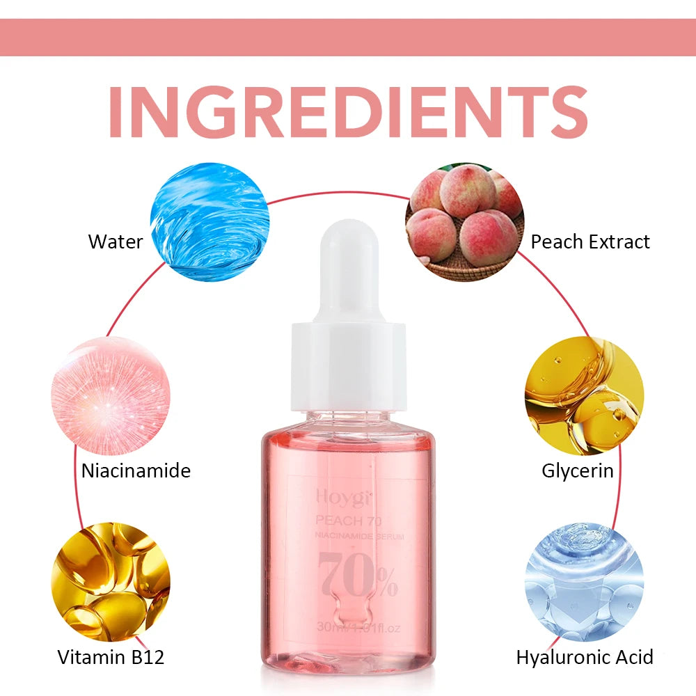 30ml Niacinamide Dark Spot Serum – Brightening & Hydrating