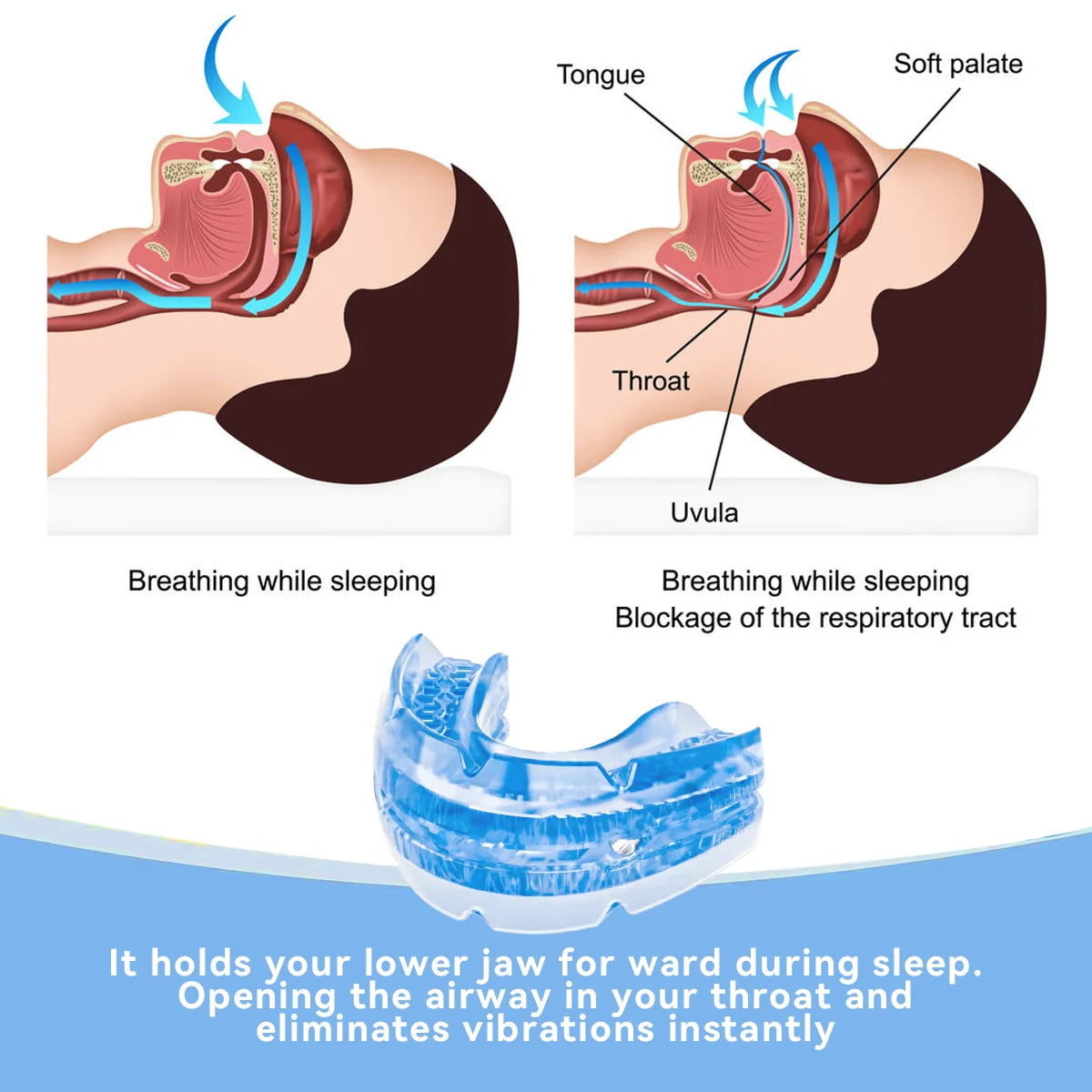 Anti-Snore & Bruxism Mouth Guard