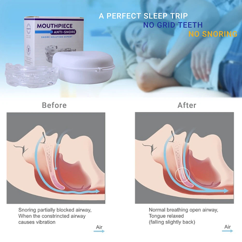 Anti-Snore & Bruxism Mouth Guard with Case