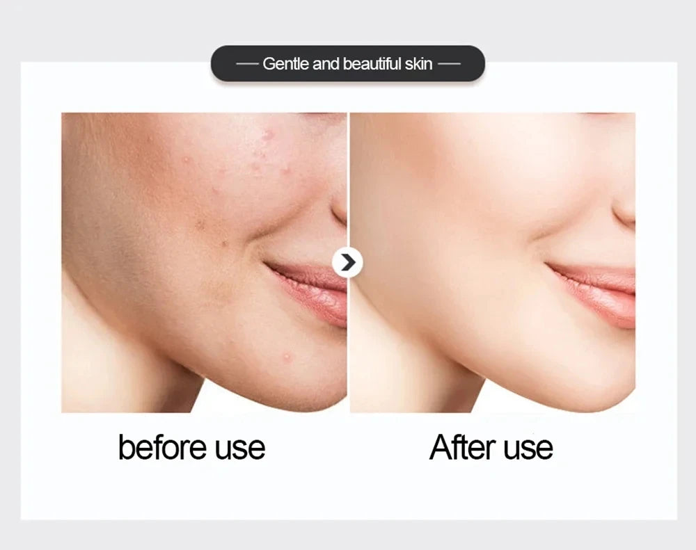 500ml Niacinamide Essence Toner – Hydrating & Brightening Facial Care