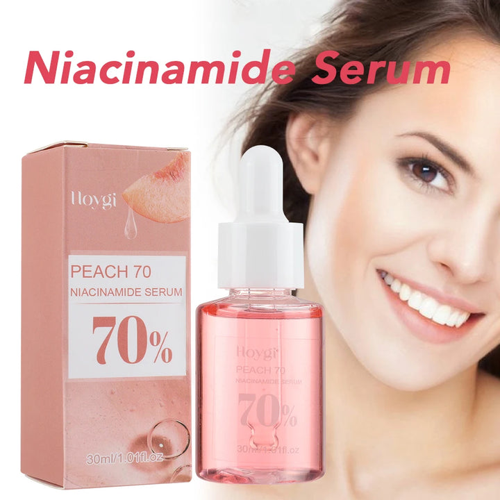 30ml Niacinamide Dark Spot Serum – Brightening & Hydrating