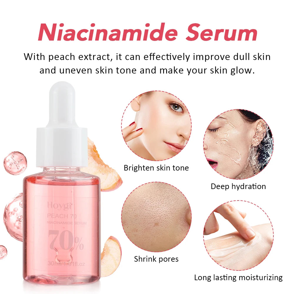 30ml Niacinamide Dark Spot Serum – Brightening & Hydrating